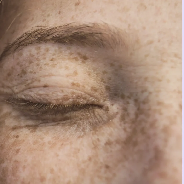 close up of beautiful young woman with freckles