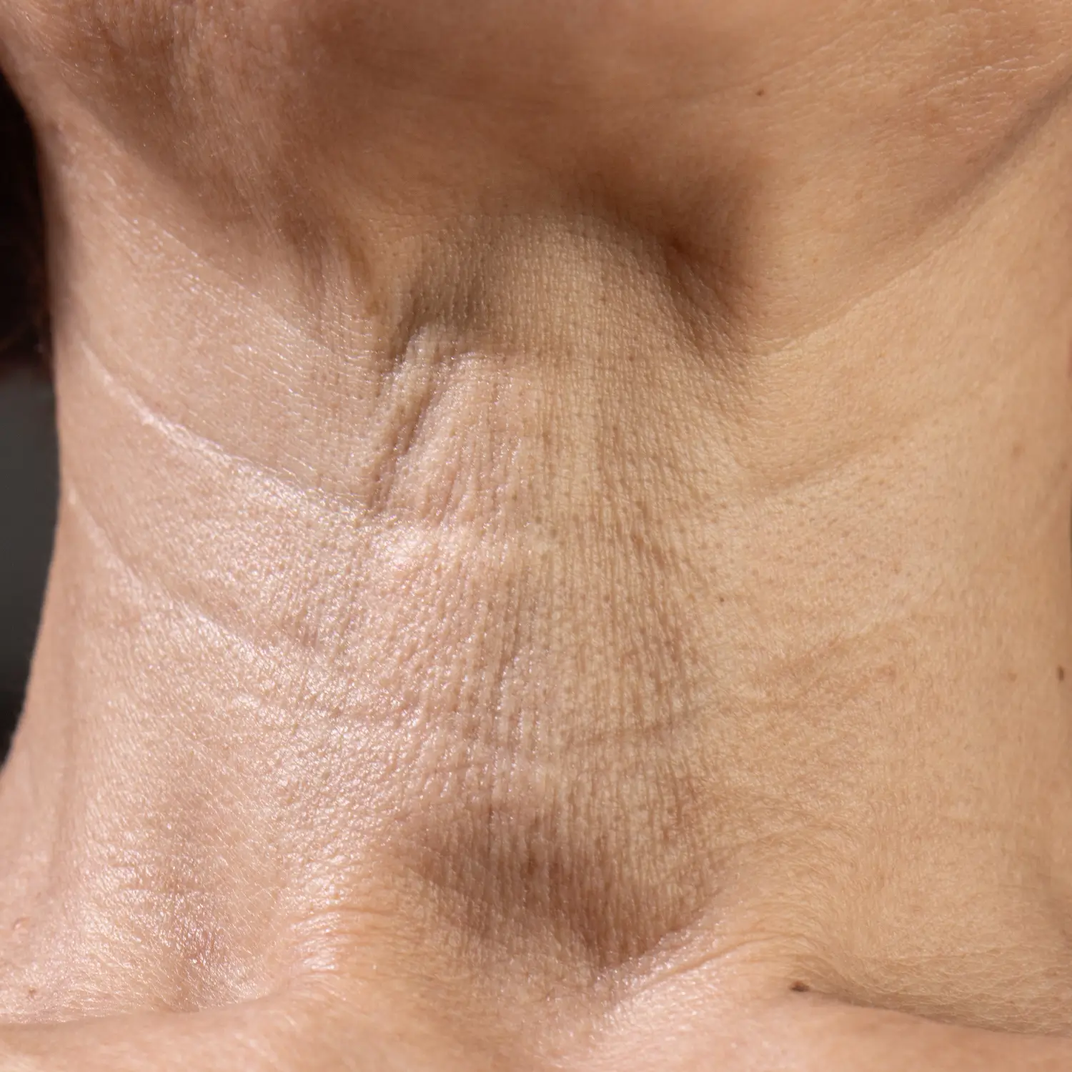 closeup of woman with crepey neck