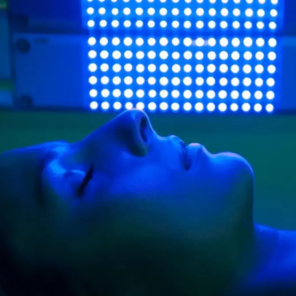 acne led light therapy blue light therapy los gatos ca