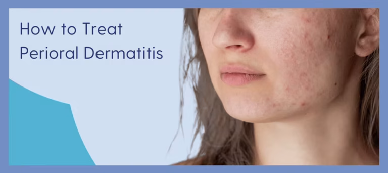 Perioral Dermatitis: What It Is & How to Treat It